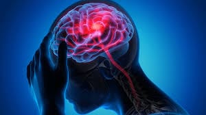 Desenho de um cérebro com destaque para algumas cores ermelhas no centro