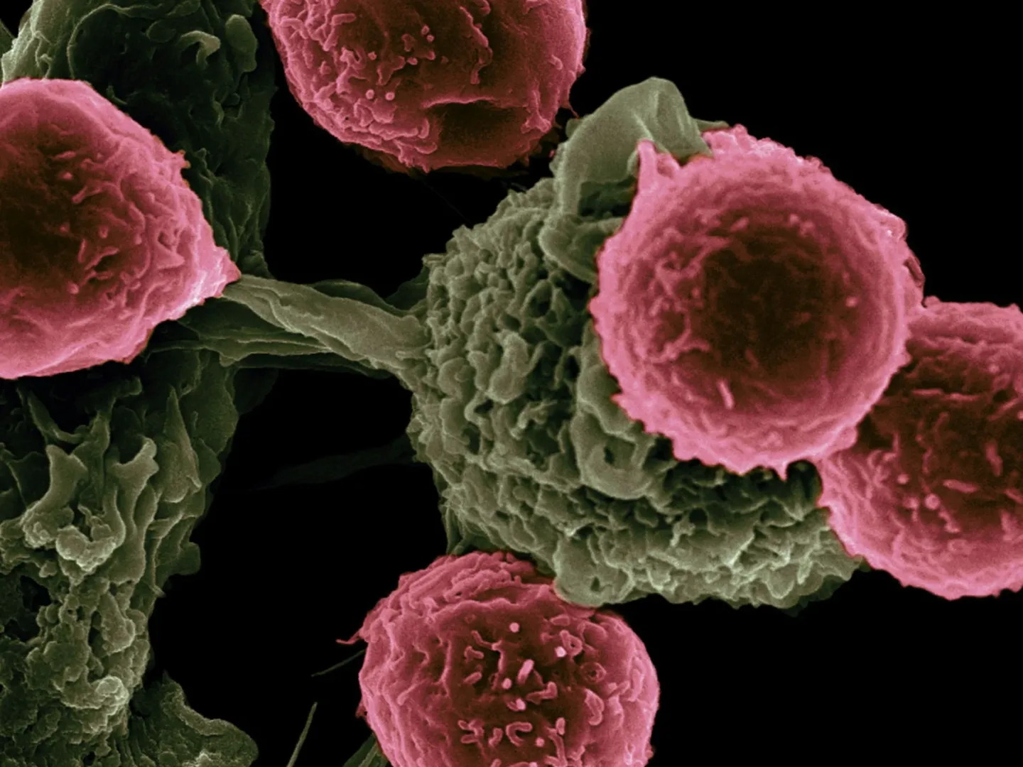 Células cancerígenas