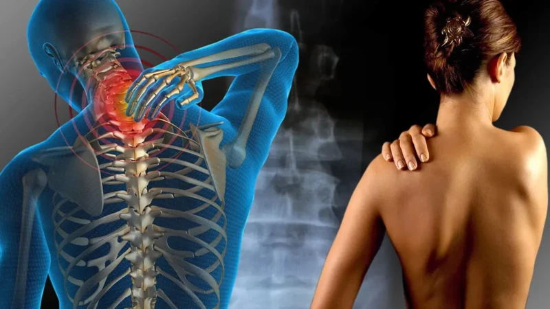 Ilustração de esqueleto com dor na cervical e mulher segurando o ombro com expressão de dor