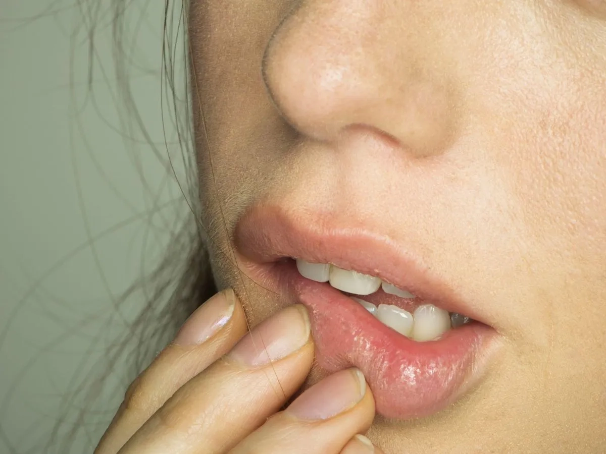 labios