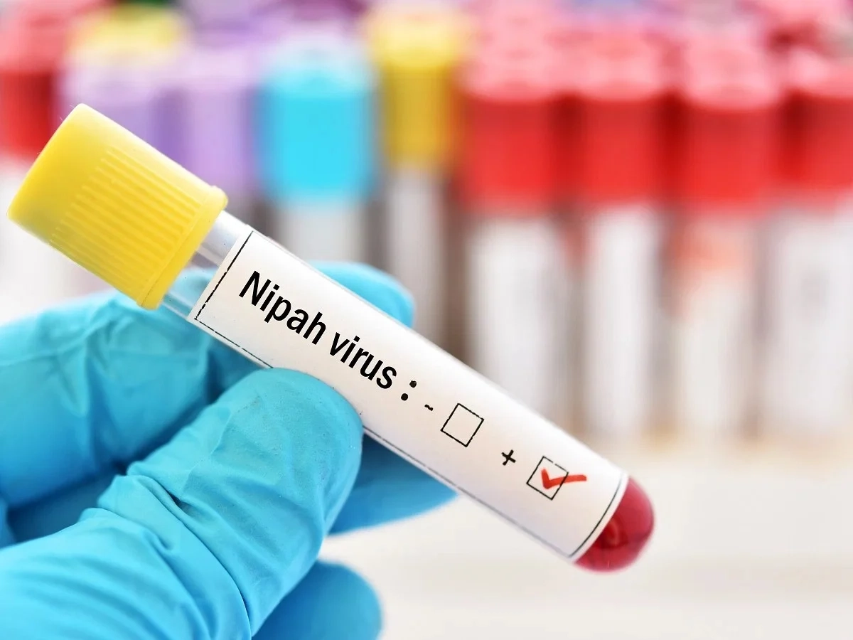 nipah-virus-positive-jpeg