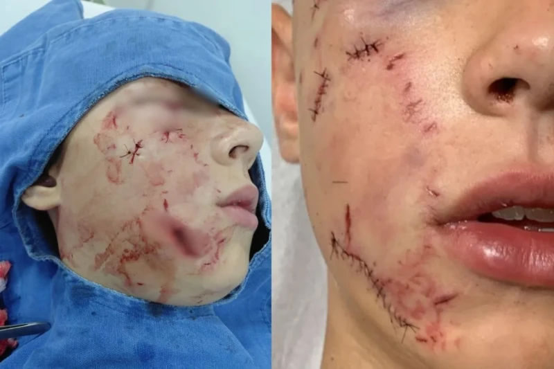 766218-20260331-171603-308437