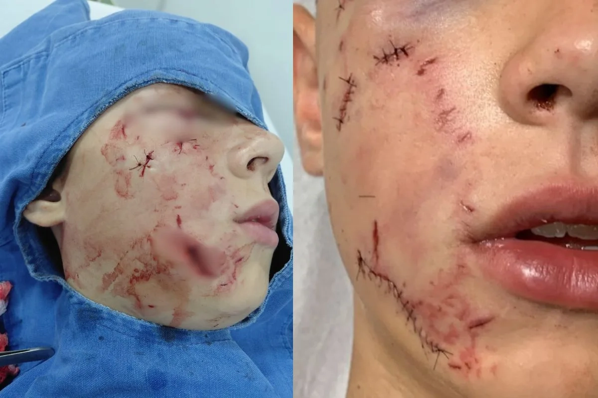 766218-20260331-171603-308437