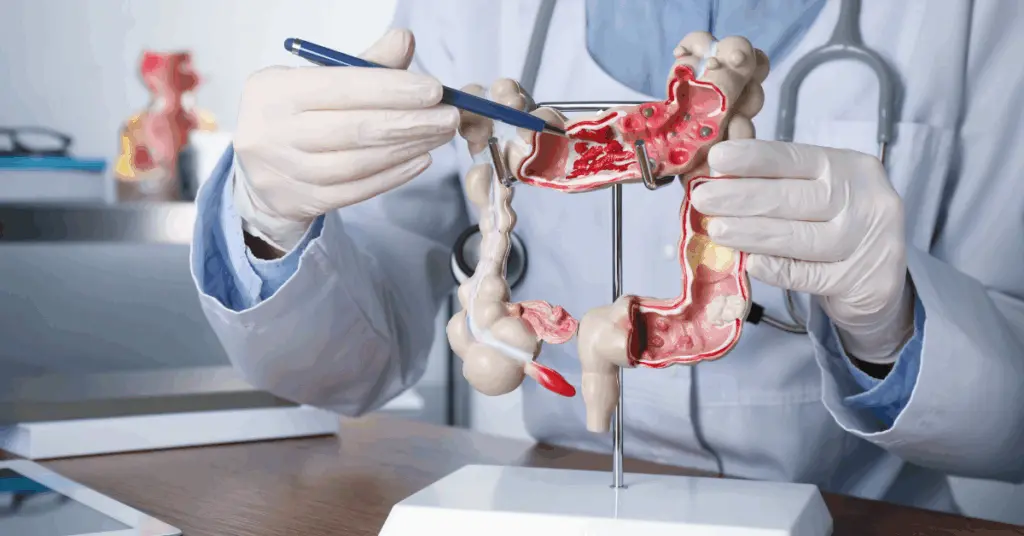 Retirada-do-Intestino-Quando-a-Colectomia-e-Necessaria-1-1024x536