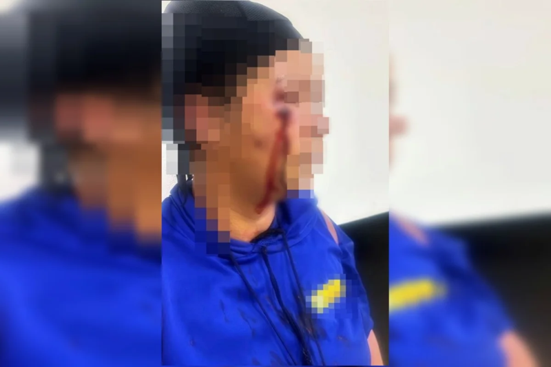 Mulher aparece com ferimento e sangramento no rosto após agressão registrada em Cristalina, Goiás.