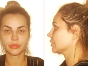 Montagem com fotografias de Deolane Bezerra de frente e de perfil, com o cabelo preso.